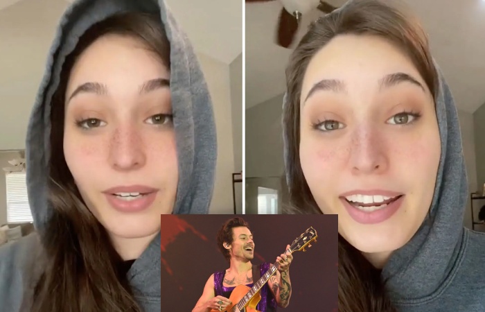 Harry Styles Bald – TikTok